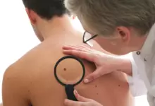 Бенките и съдбовните знаци