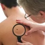 Бенките и съдбовните знаци