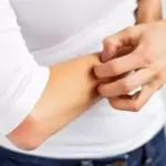 Дразнители на кожата